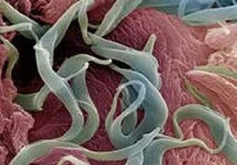 Symptômes et traitement des parasites dans le corps humain