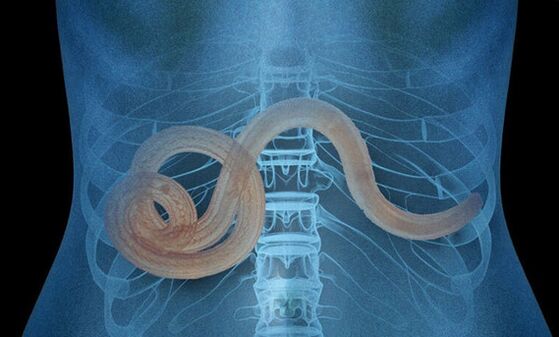 parasite dans le corps humain