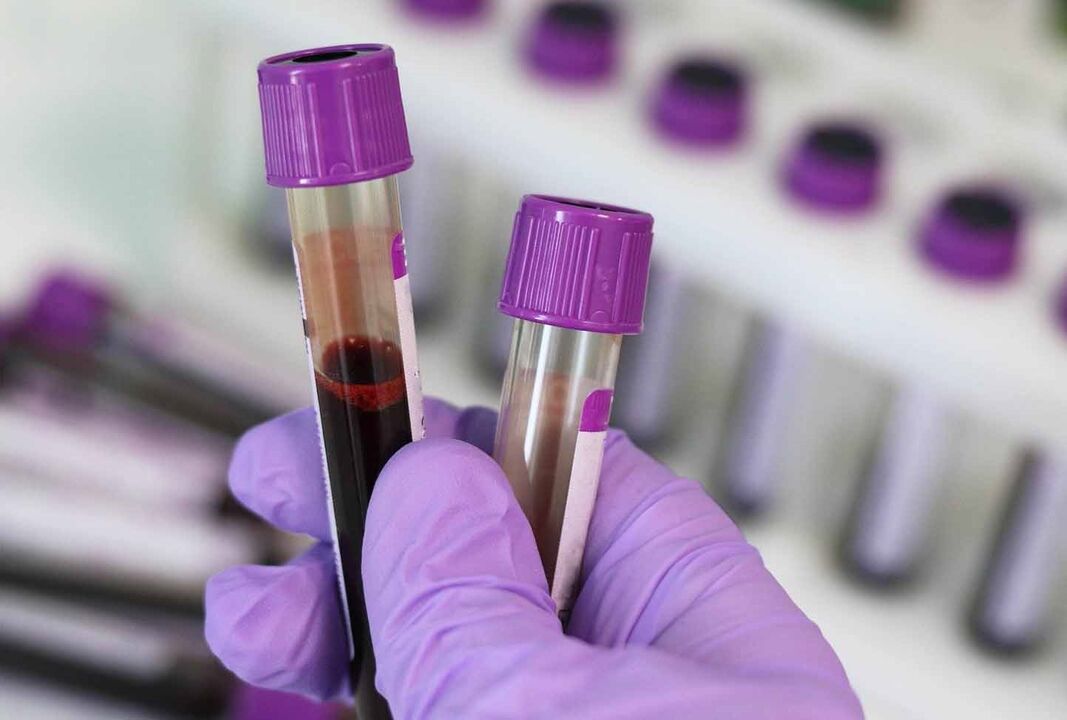 test sanguin pour les parasites